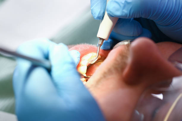 Best Weekend Emergency Dentist in Gun Barrel City, TX