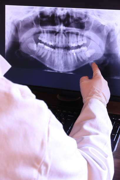 Best Emergency Root Canal Treatment in Gun Barrel City, TX