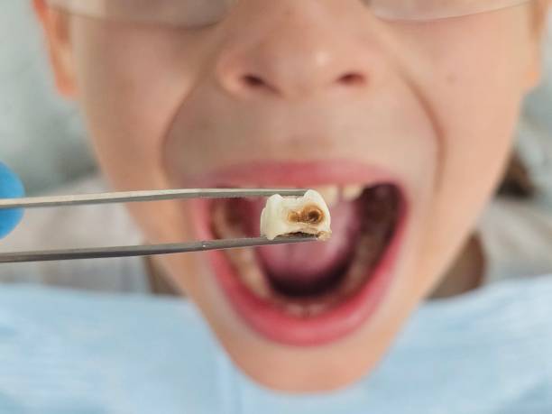 Best Mobile Emergency Dentist in Gun Barrel City, TX